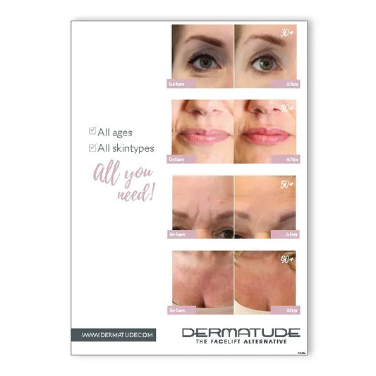 Poster/Foam Board Before/After (42×29 cm)